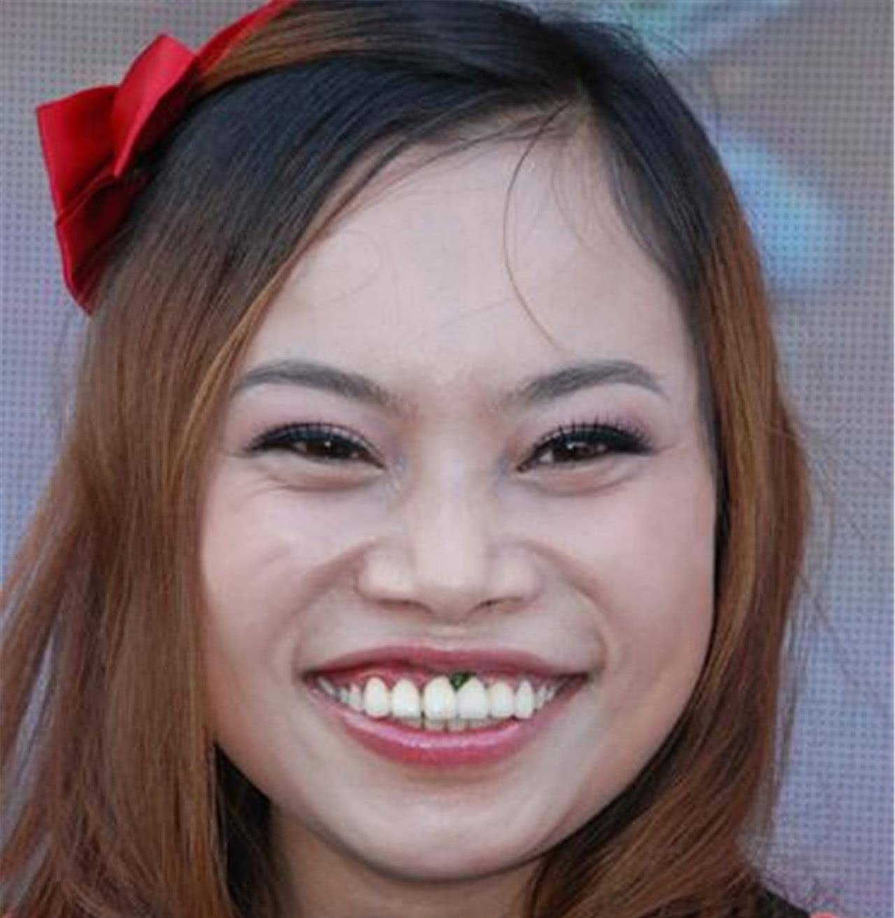 凤姐整容后最新照片,审美变迁下的公众观点探析与自我重塑之路