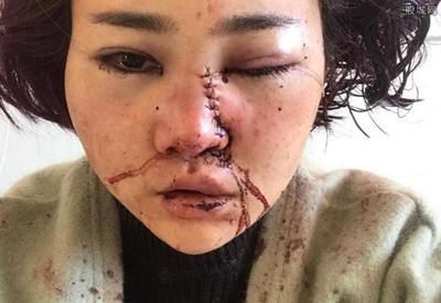 丽江毁容事件最新进展,科技助力重塑安全与日常生活