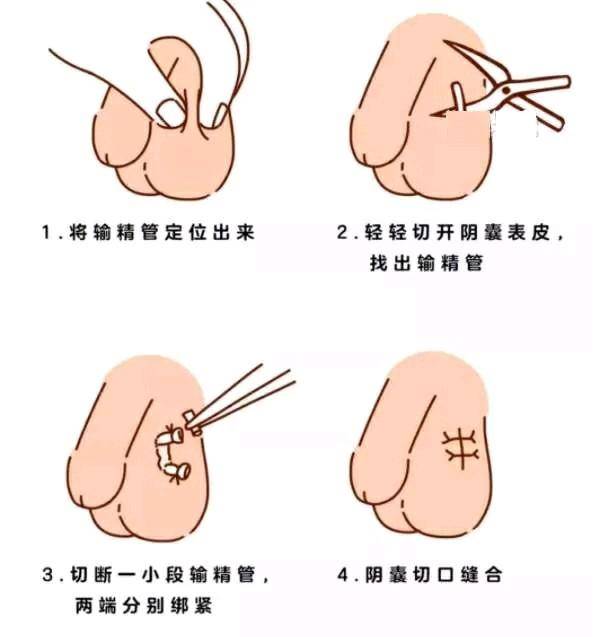 男人最新节育，心灵与自然的完美交融之旅