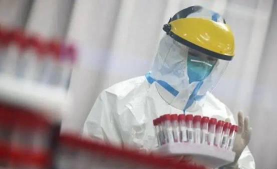 疫情下的日常趣事,最新疫情带来的生活点滴分享