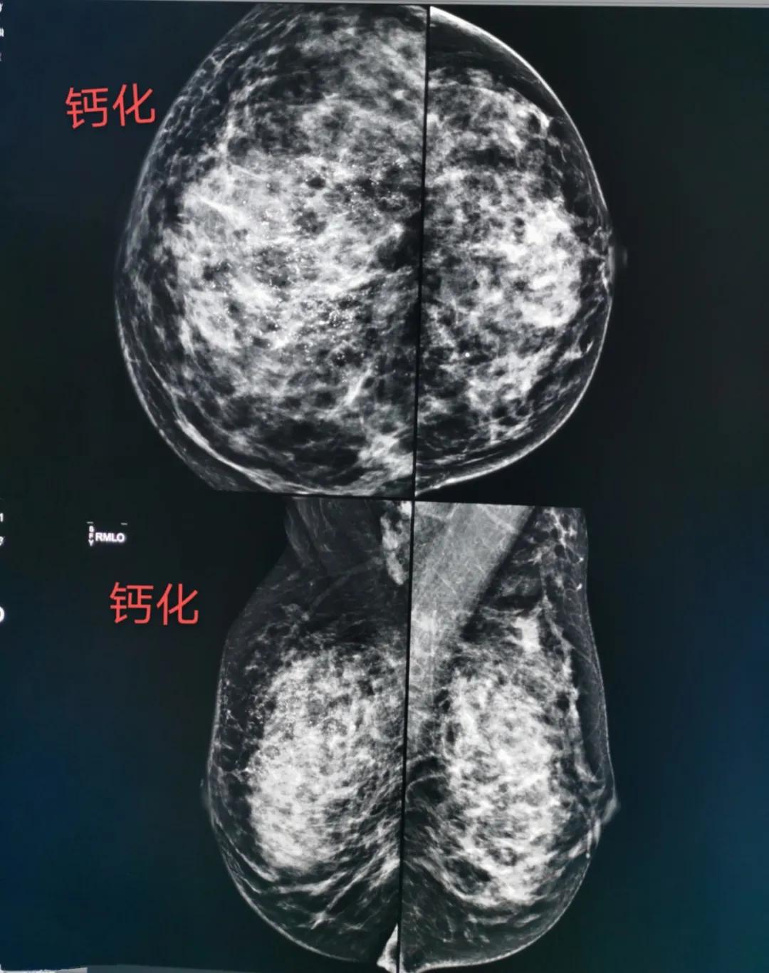 第1569页