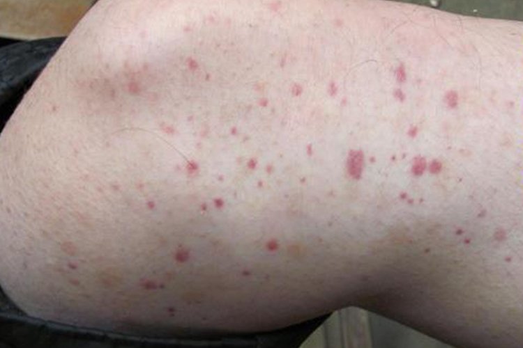 瘀点最新版,探寻变化中的自信与成就,点亮人生光芒